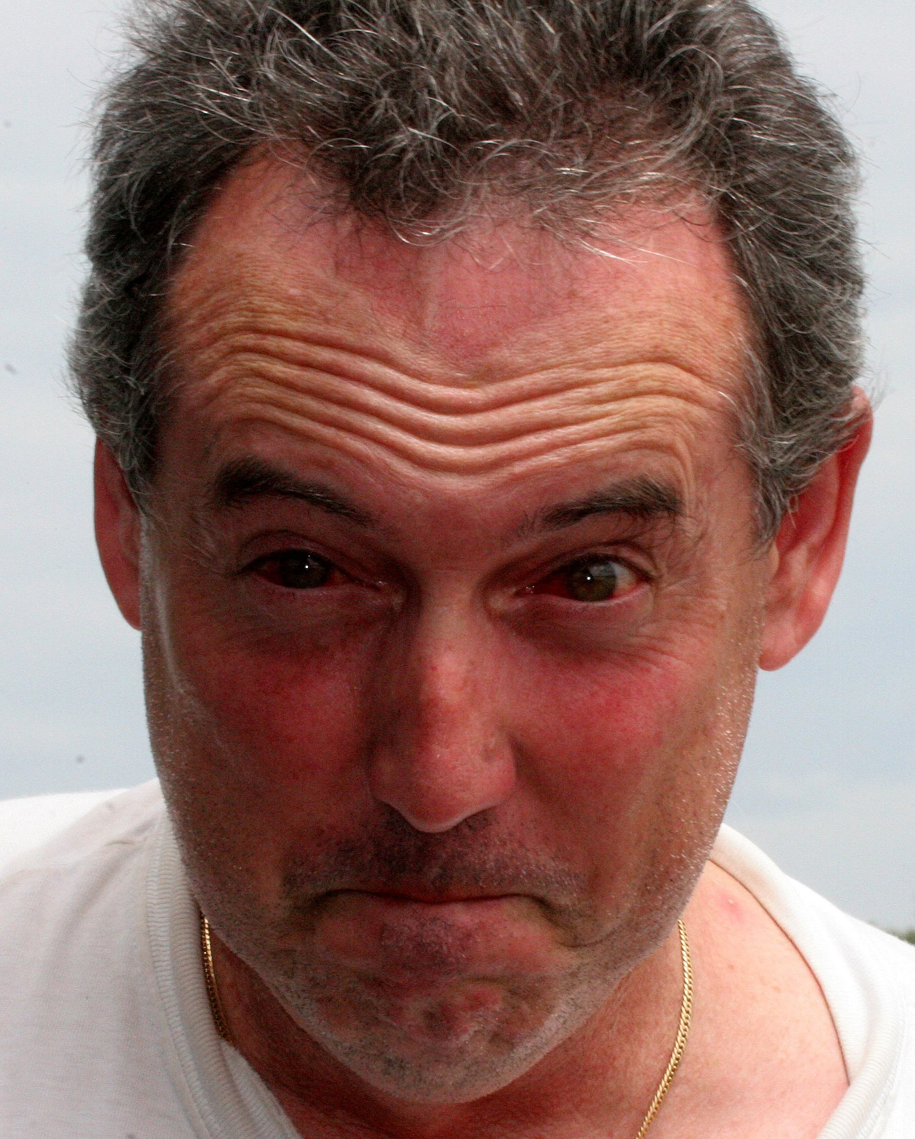 KINABATANGAN RIVER BORNEO - SPIDER BITE RED EYED ME.JPG