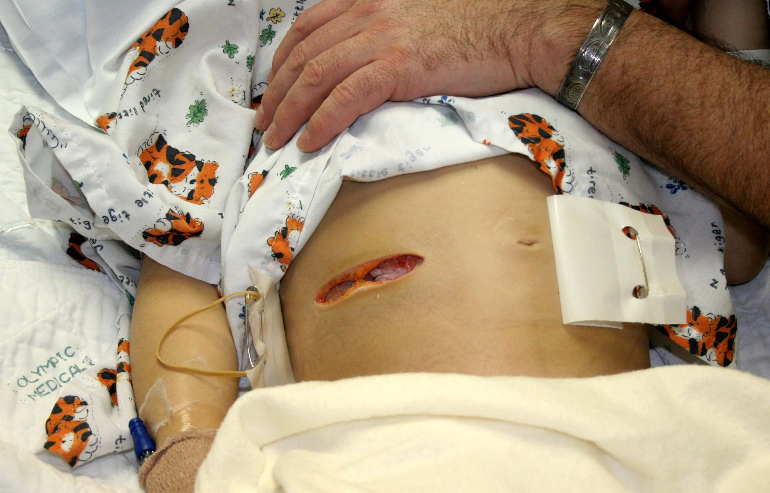 2008-1-12 COKIES APPENDICITIS (4).jpg