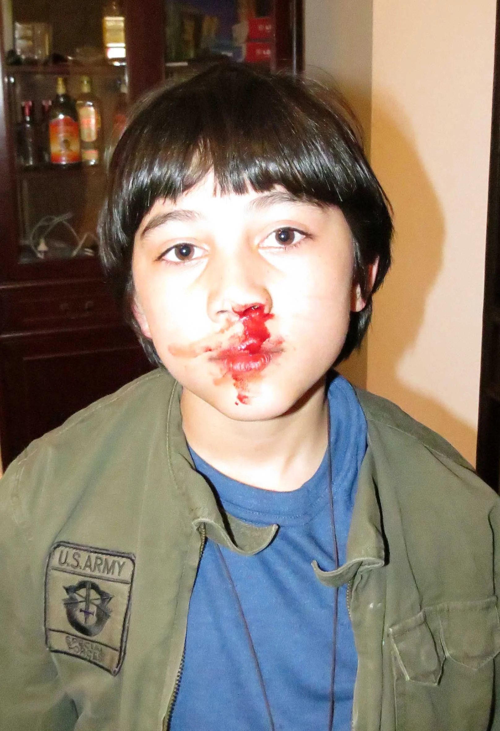 COKIE'S FIRST BLOODY NOSE MARCH 14 2012 (4).JPG