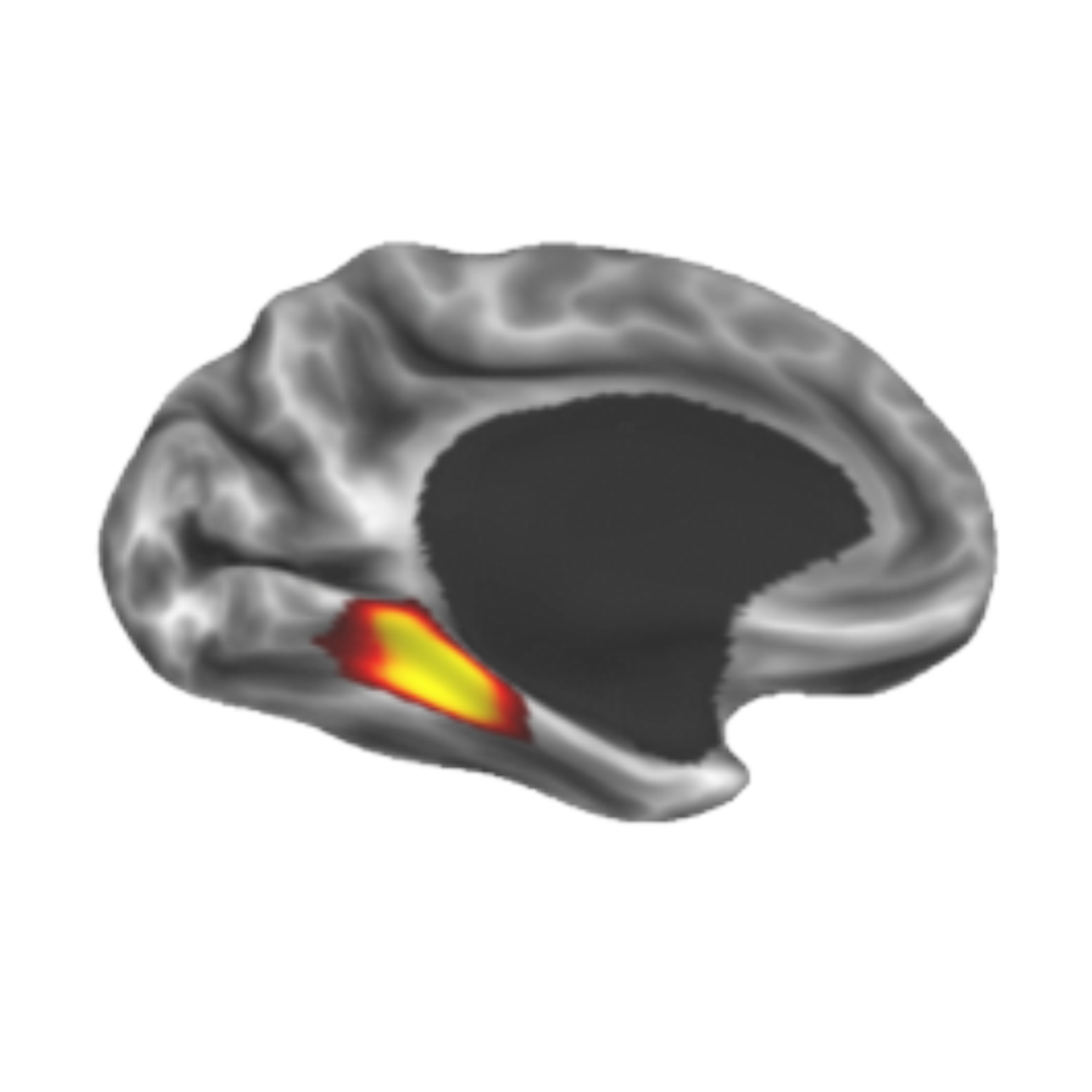 The MTL200: a surface-based, probabilistic atlas of the medial temporal lobe