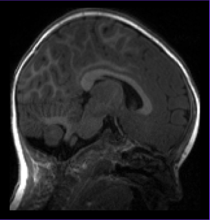 Functional Magnetic Resonance Imaging in Awake Infants: Insights From More Than 750 Scanning Sessions