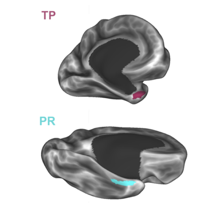 Three distinct profiles of visual category preference within the anterior temporal lobe
