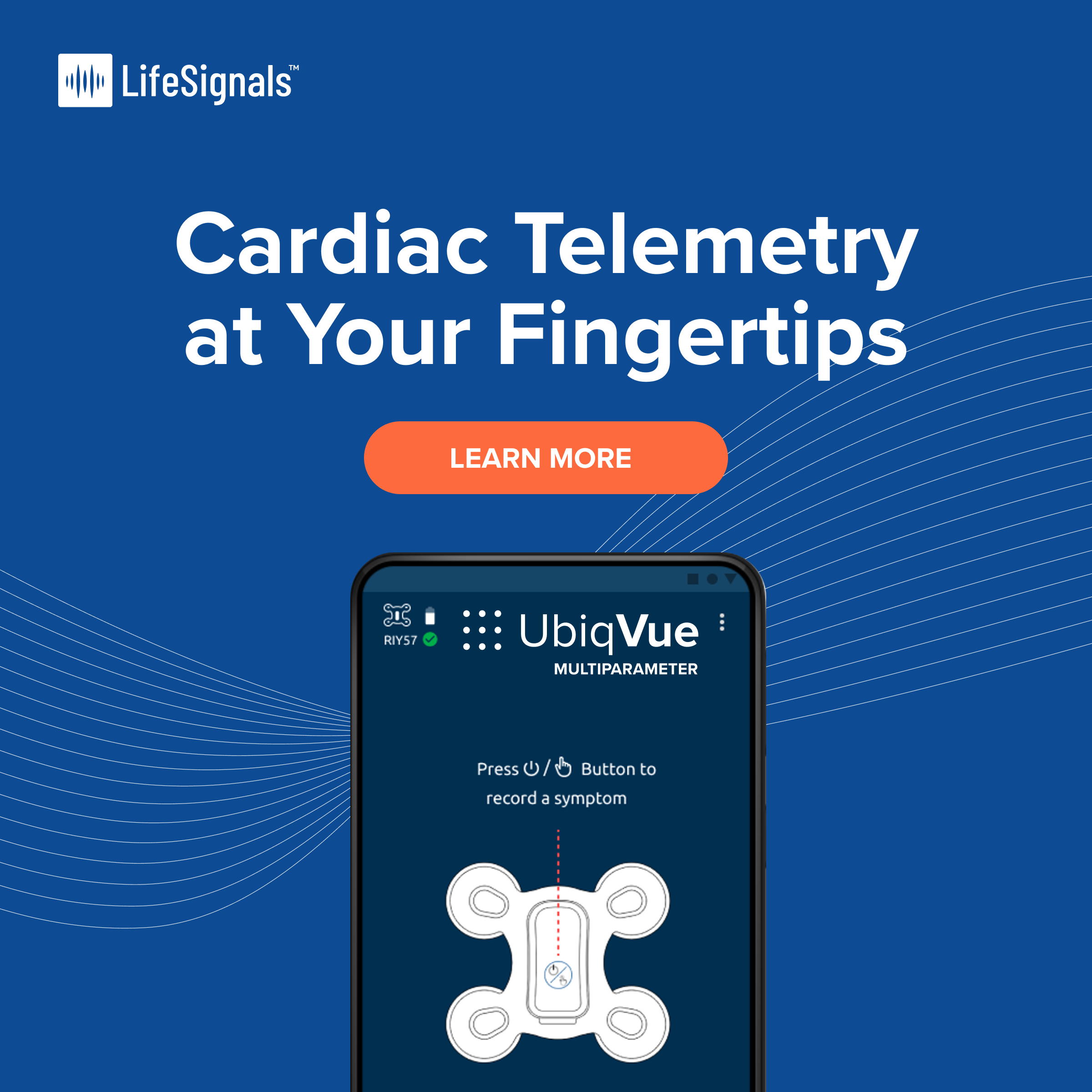 Cardiac Telemetry at Your Fingertips.png