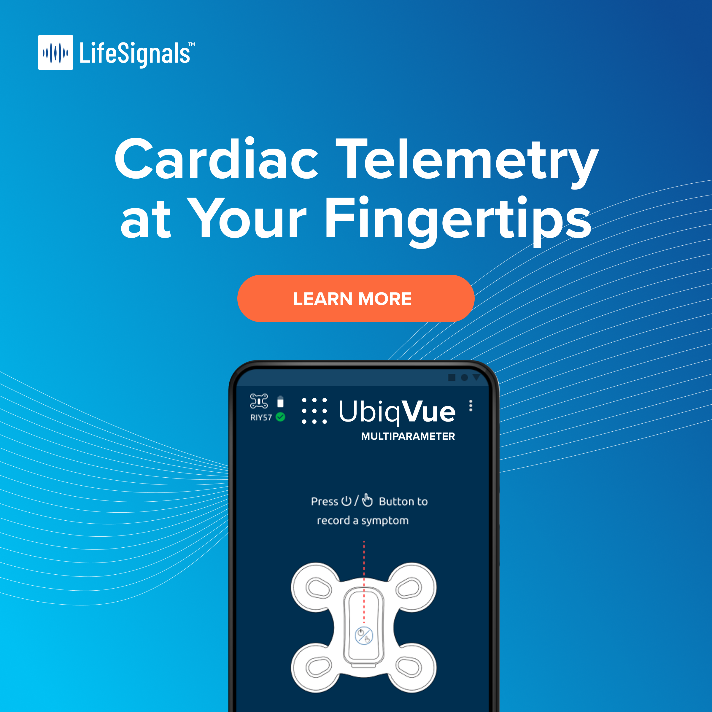 Cardiac Telemetry at Your Fingertips-1.png