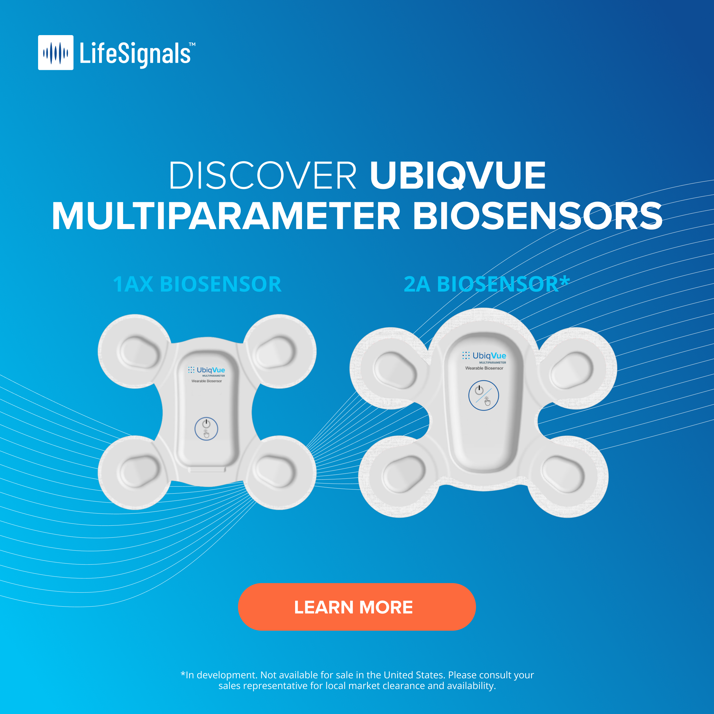 Cardiac Telemetry at Your Fingertips.png