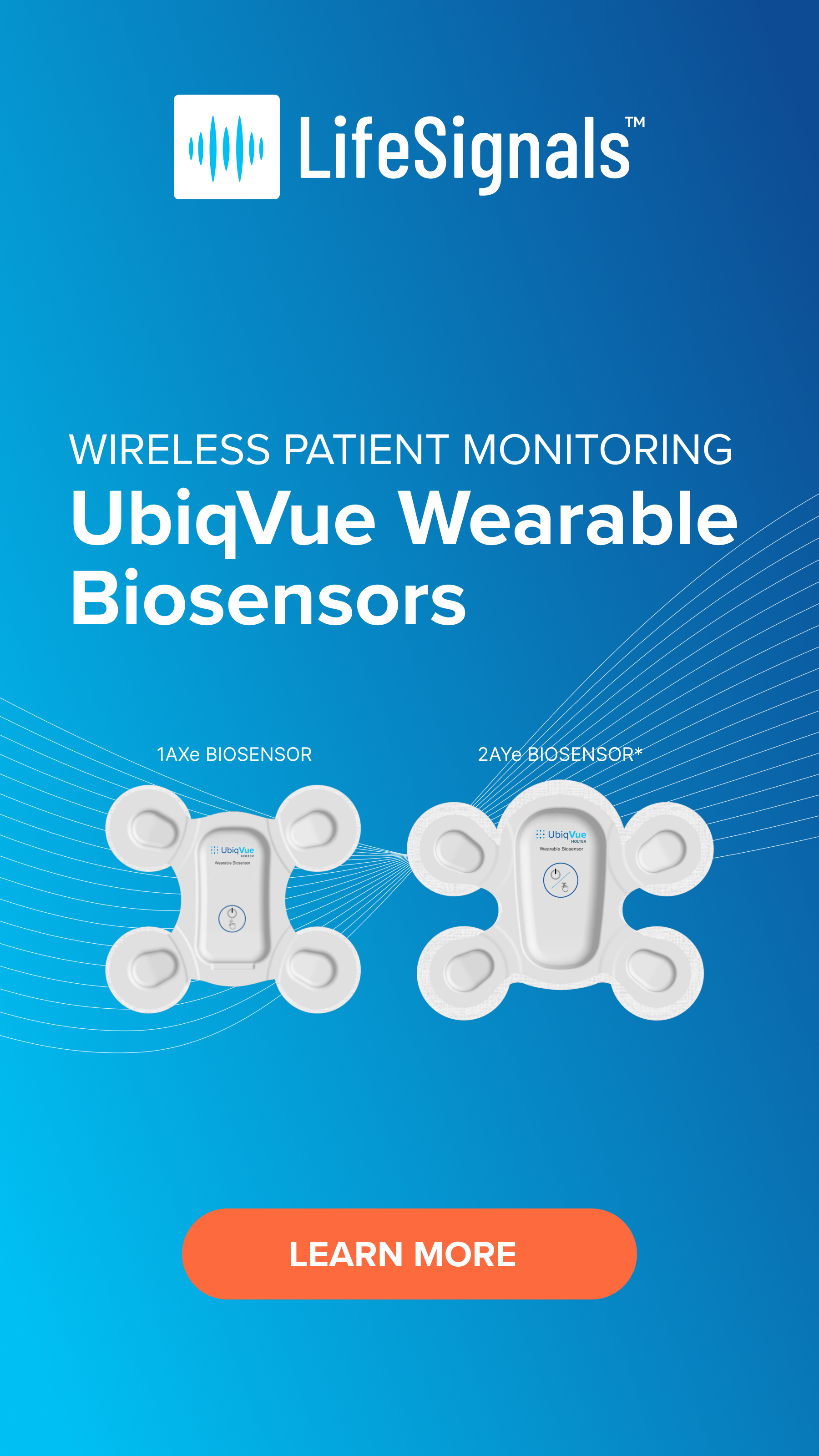 Wireless Cardiac Holter Monitoring.png