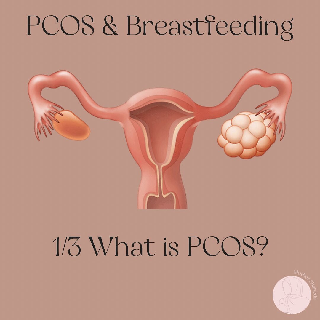 🌸Polycystic ovaries syndrome &amp; breastfeeding- 1/3 What is PCOS?🌸

Again, a bit of a biology less just to start us off! I know many women that are not diagnosed with this until their adulthood and go through their teenage years just struggling w