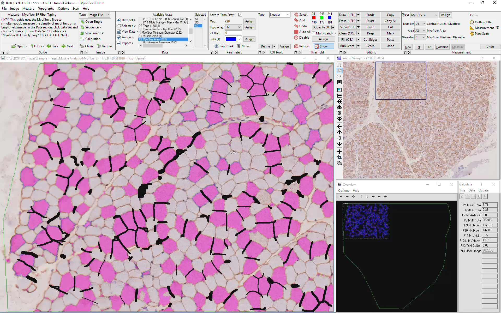 Myofiber_bf_fibertyping-type2-edited.png