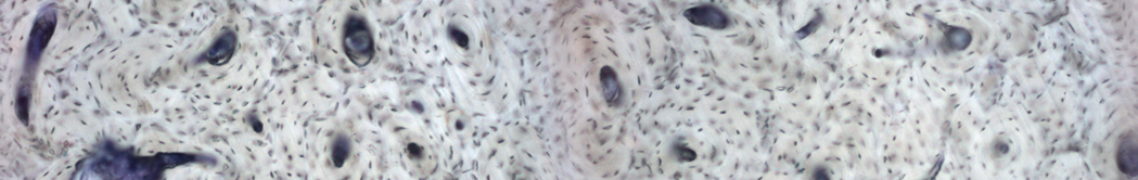 Cortical-Bone-BG.PNG