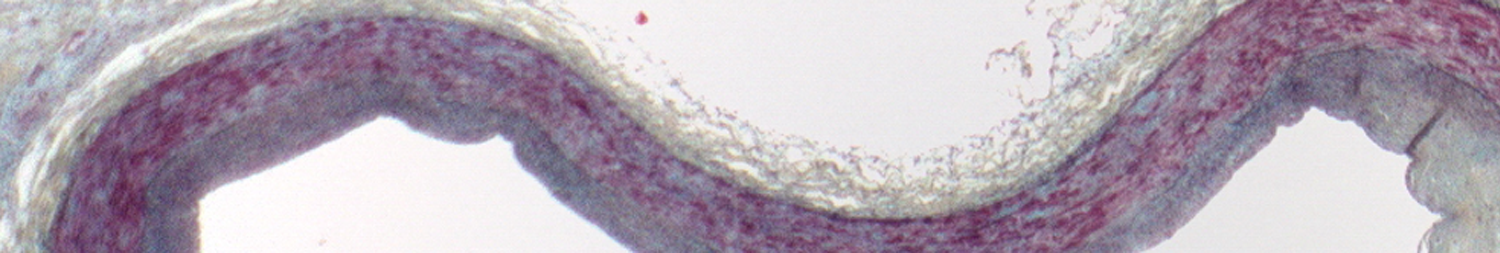 blood_vessel_banner.png