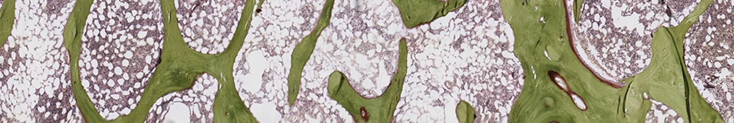 human_trichrome_banner.png