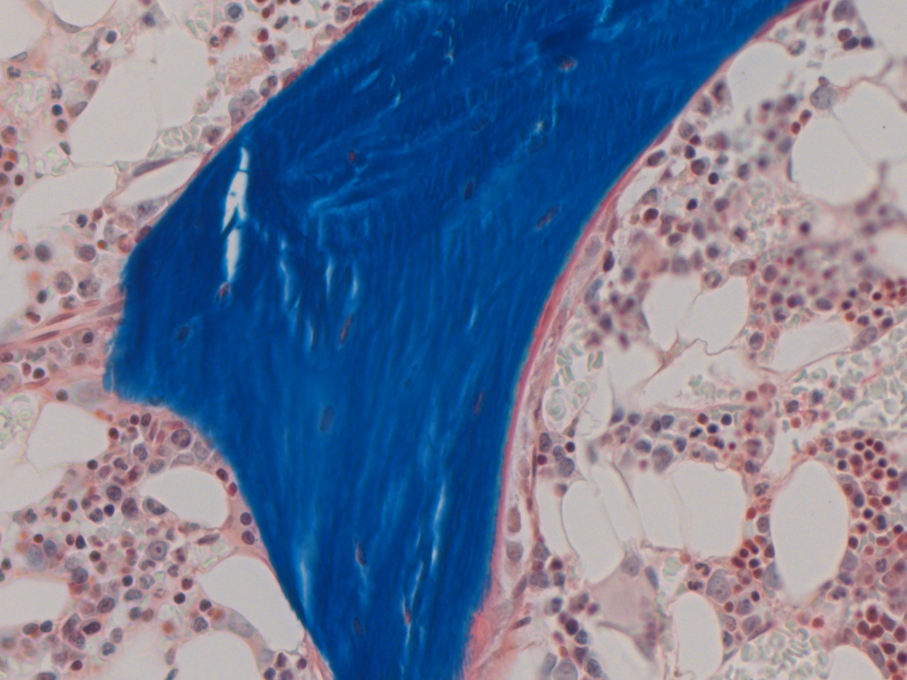 Osteoblasts and Adipocytes
