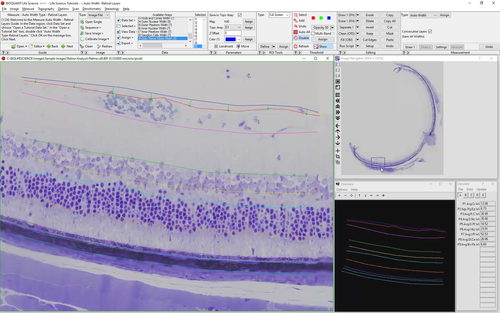 Retinal Layer Thickness