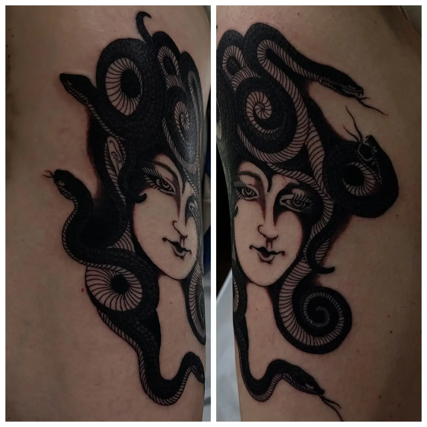 Medusa ~ thank you so much Ivona! Can't wait for this one to heal.