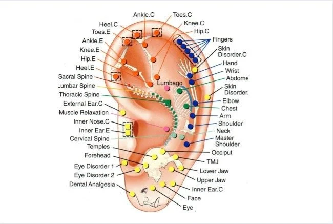 Diagram of an ear with various points marked for acupressure or acupuncture, labeled with specific body parts and conditions associated with different points.