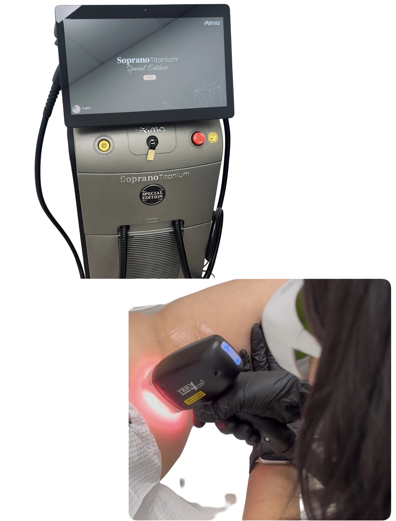Laser Hair Removal