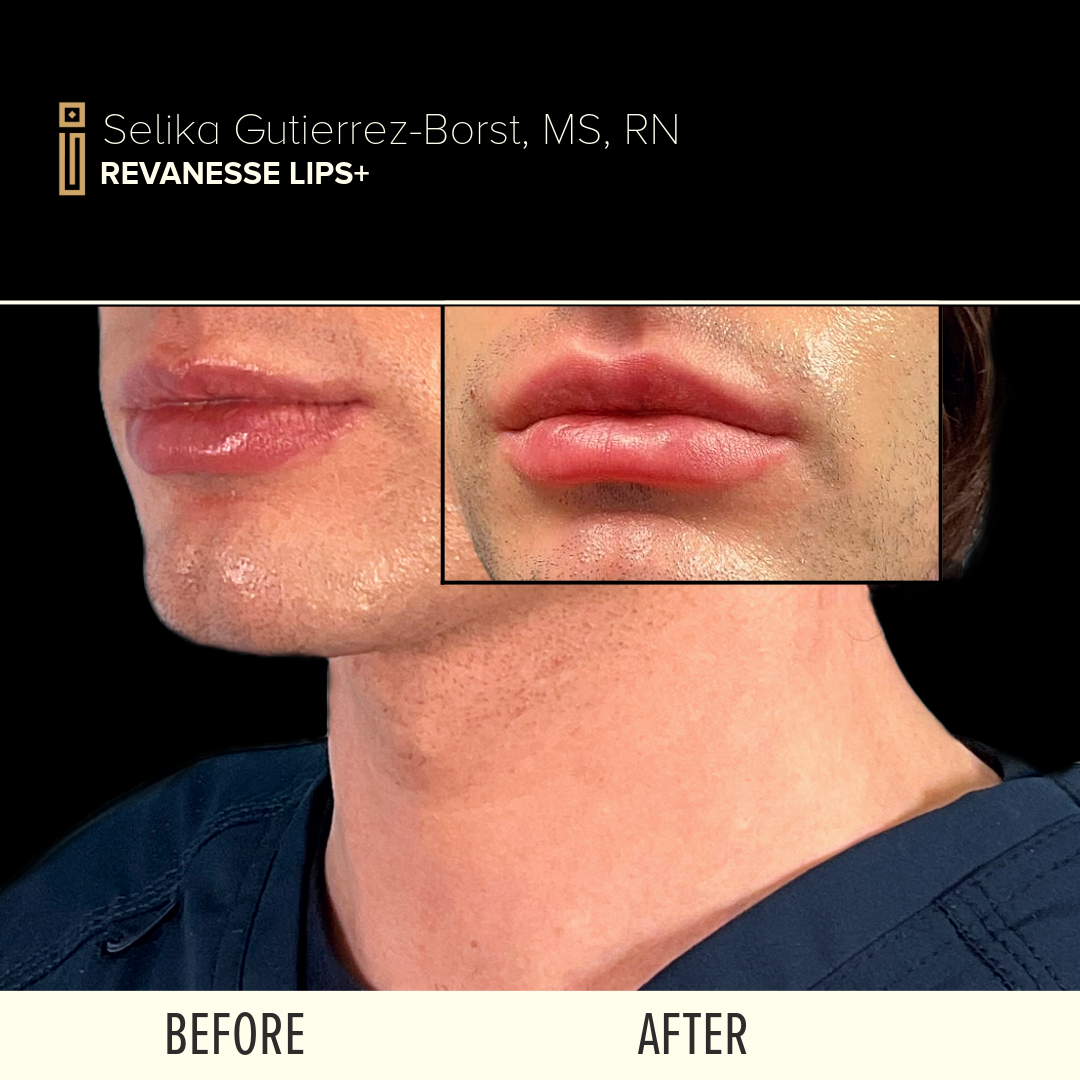 BEFORE + AFTERS-1.png