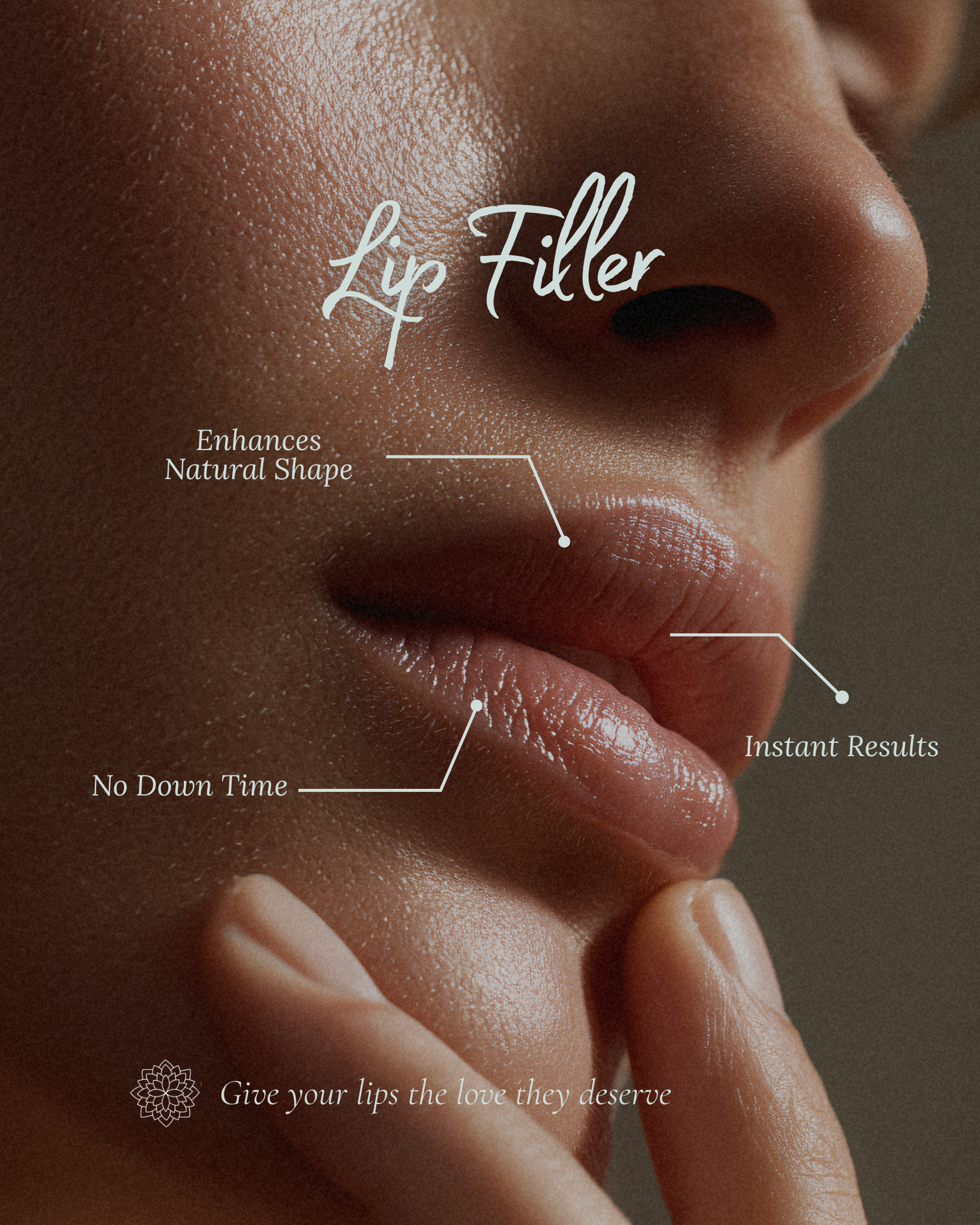 Trouvaille Social Lip Filler InfoGraphic Feb 2026.png