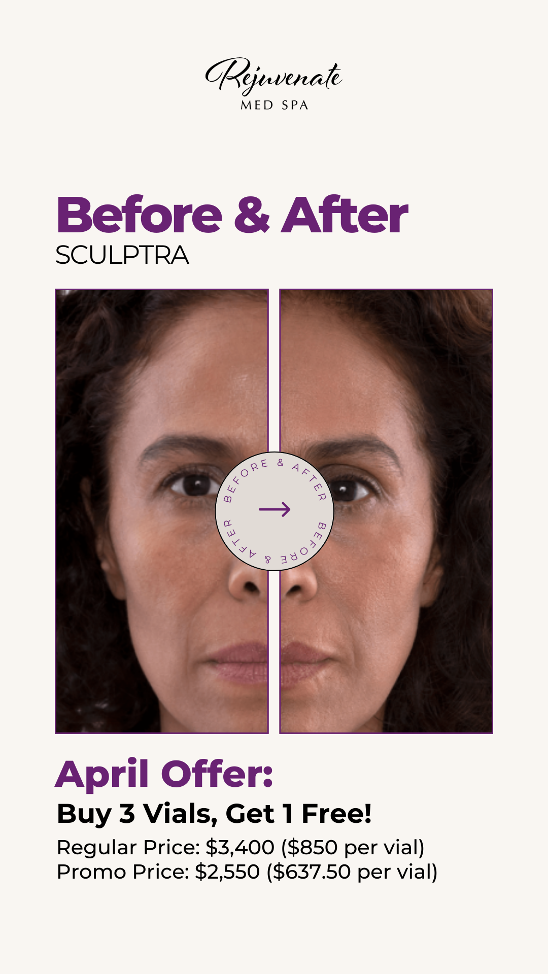2_Sculptra B&A.png