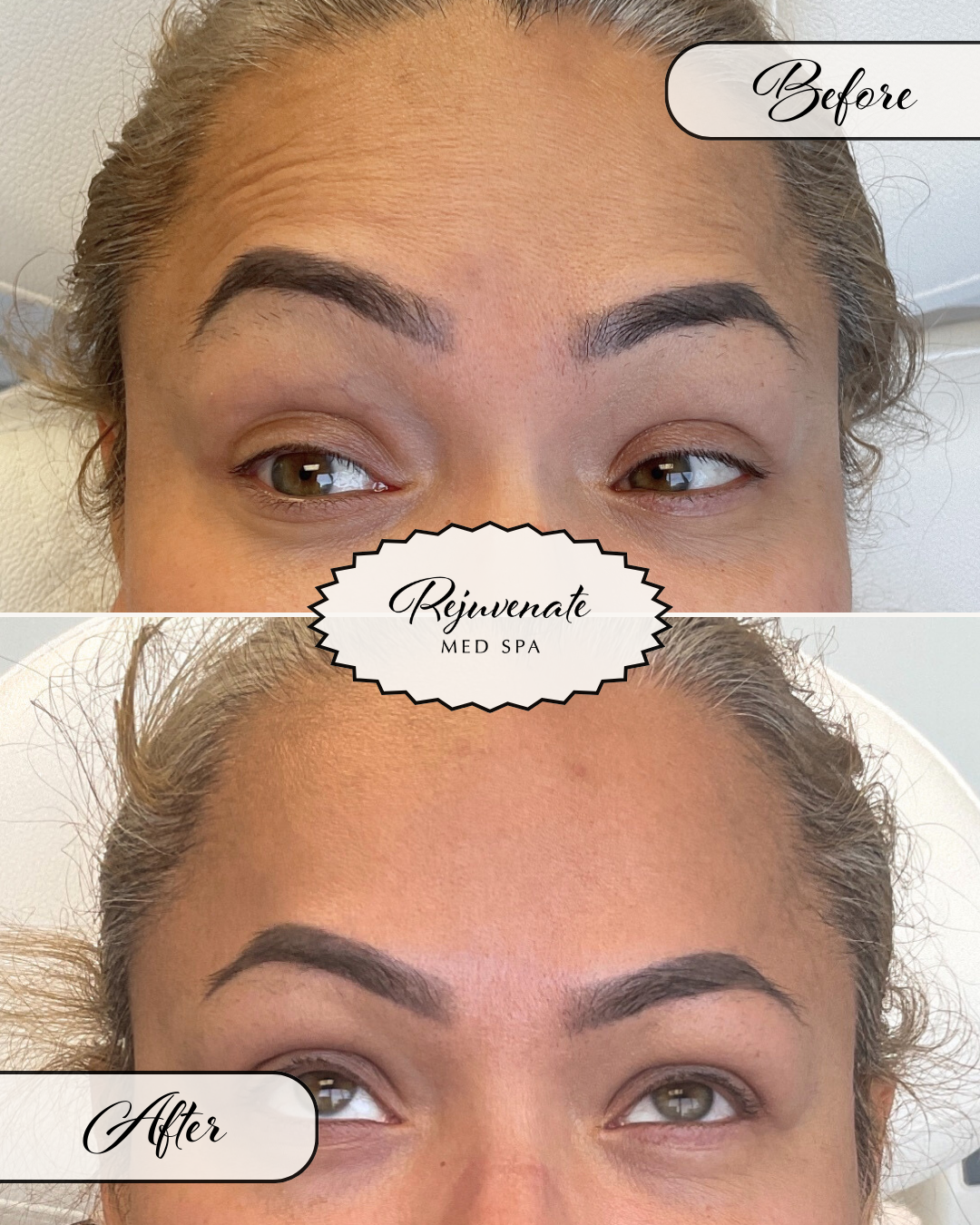 1_Copy of Rejuvenate Filler Before and After July Social Content.png