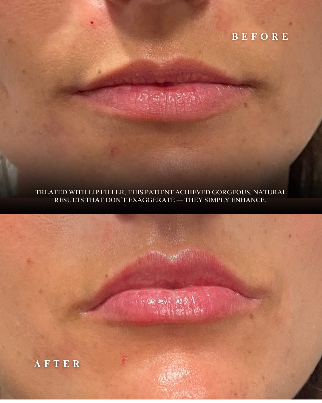 Trouvaille Sept.  Social Content - Before & After-2.png