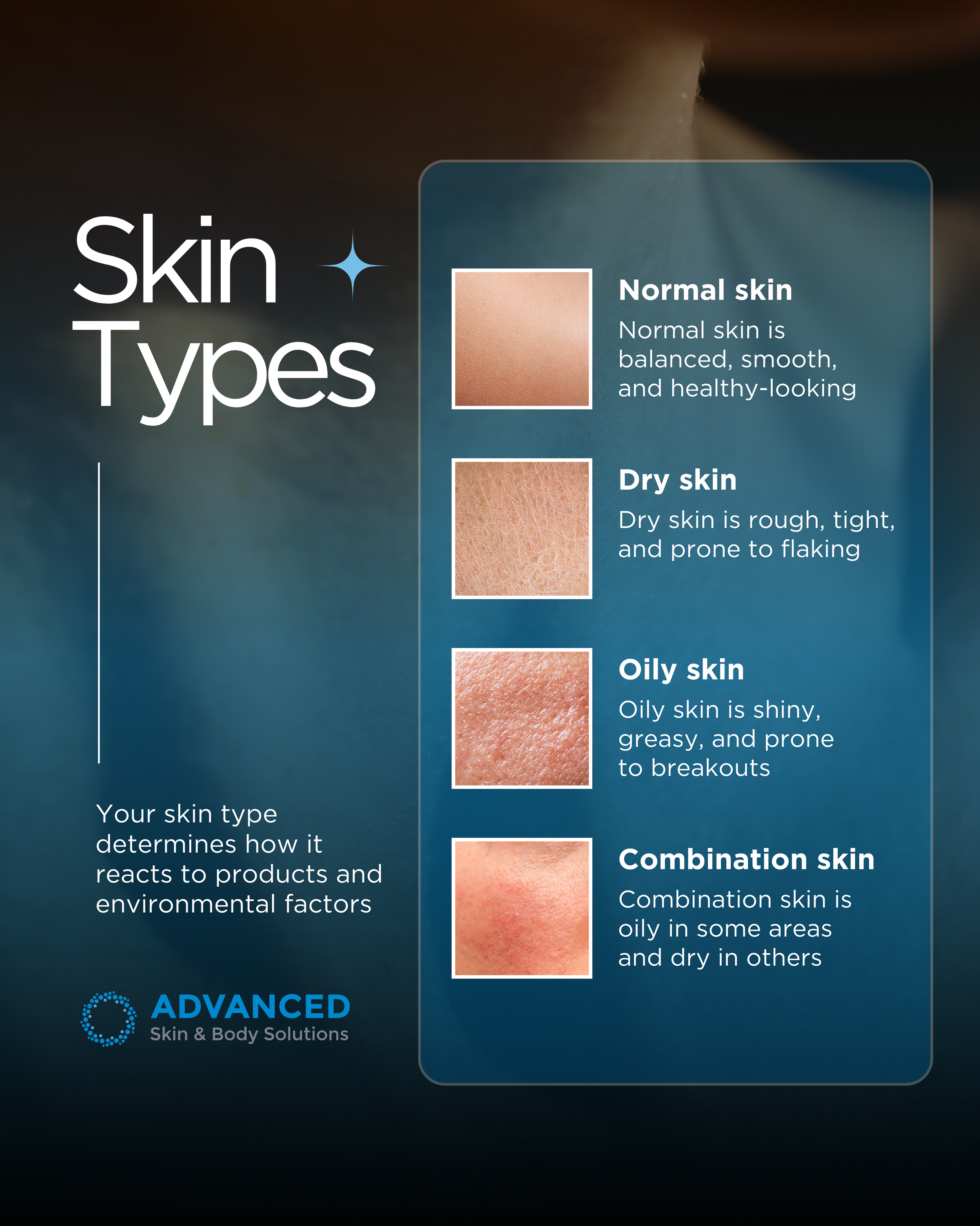 Skin Type Test V1.png