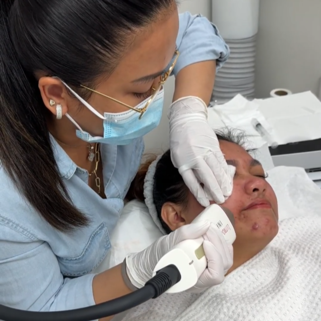 What Is RF Microneedling and How Does It Work?