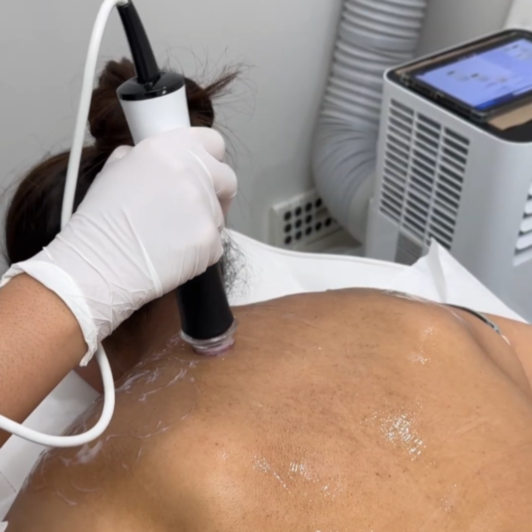 OxyGeneo: Not Just a Facial, It’s a Full-Body Glow