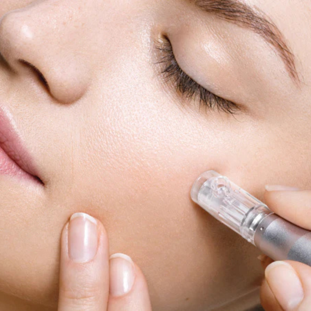 Fall Into Fresh Skin: Why October is the Best Time to Start Microneedling