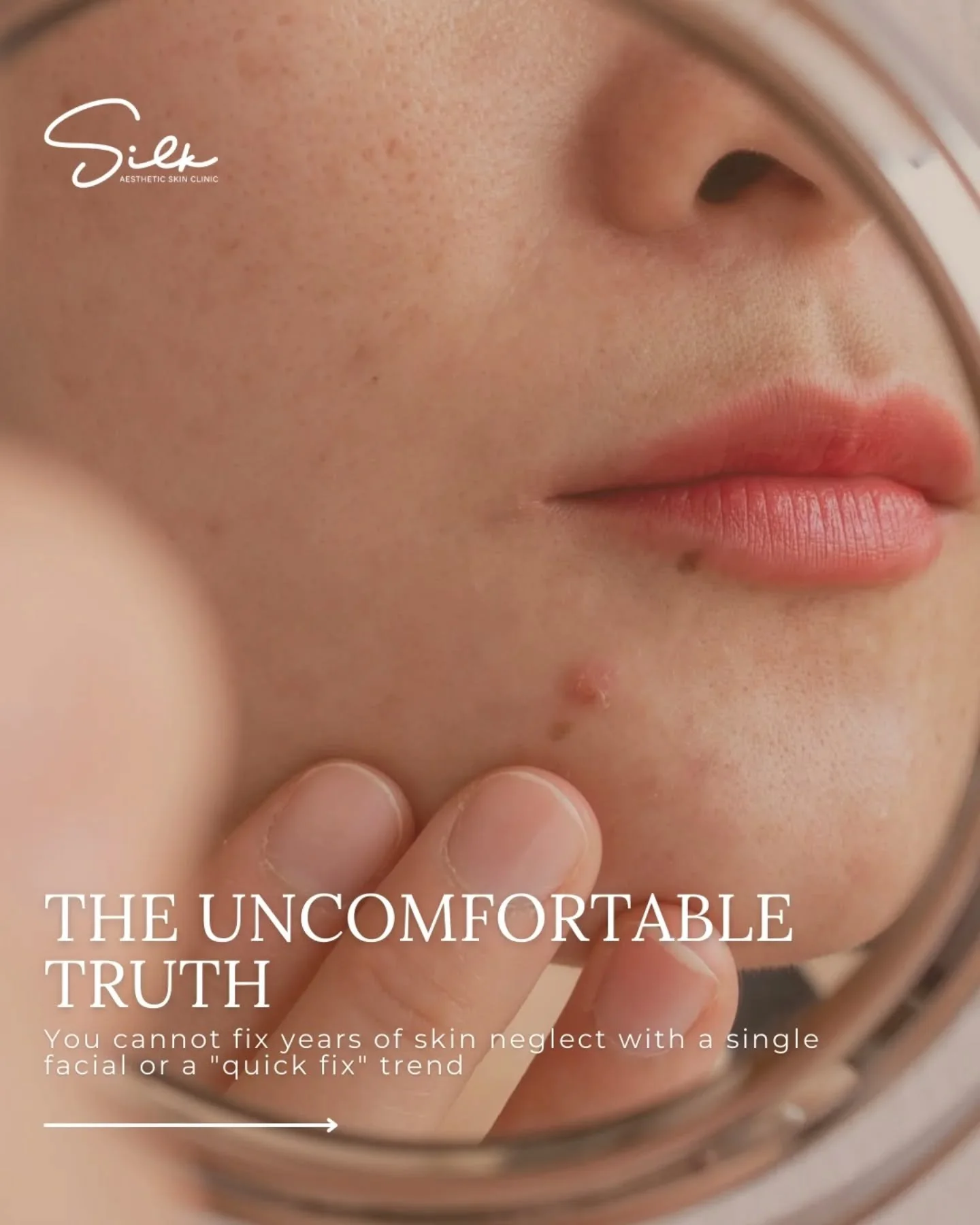 Good skin takes time and at Silk Aesthetic, we believe it&rsquo;s worth it. 💫 

Your skin needs consistency, not shortcuts. While a quick fix may give you immediate results, true radiance comes with patience and a personalized skin plan. At Silk Aes