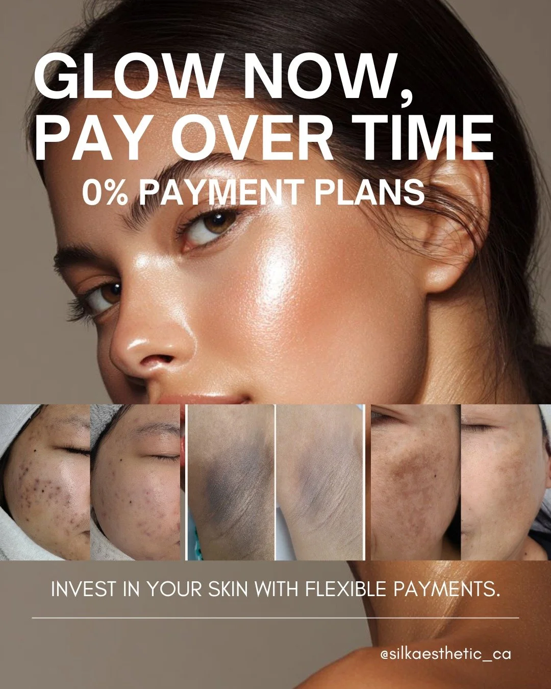 Glow now. Pay later. ✨
Real results, flexible 0% payment plans&mdash;because your skin goals shouldn&rsquo;t wait. 💆&zwj;♀️✨