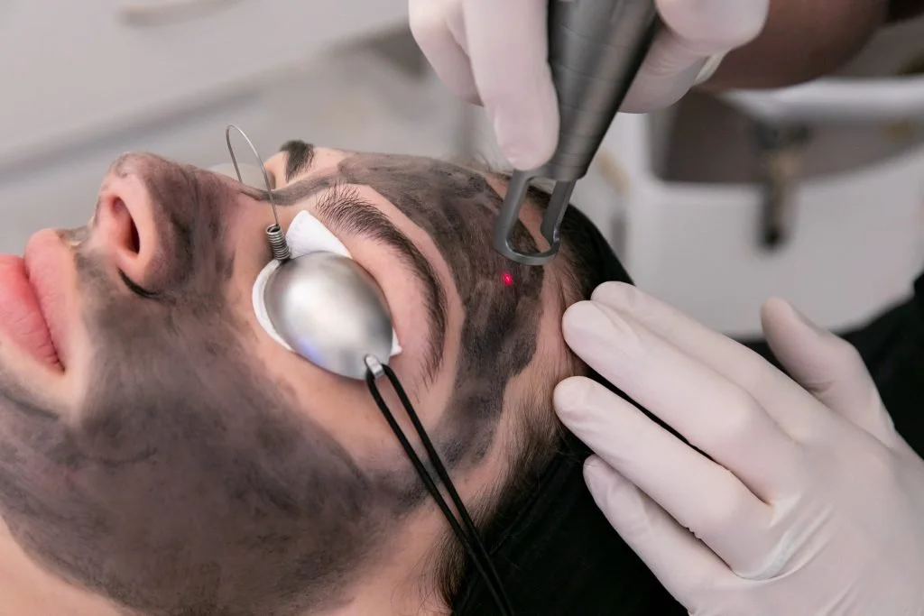 Beat Summer Dullness: How Hollywood Laser Peel Revives Tired Skin