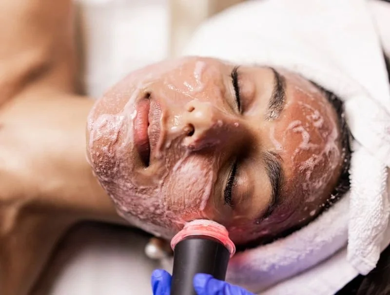 5 Summer Skin Concerns an OxyGeneo Facial Can Improve