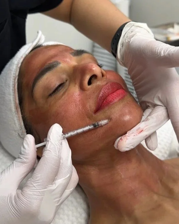 A woman receiving a cosmetic injection in her chin or jawline area during an aesthetic procedure, with healthcare professional wearing gloves.