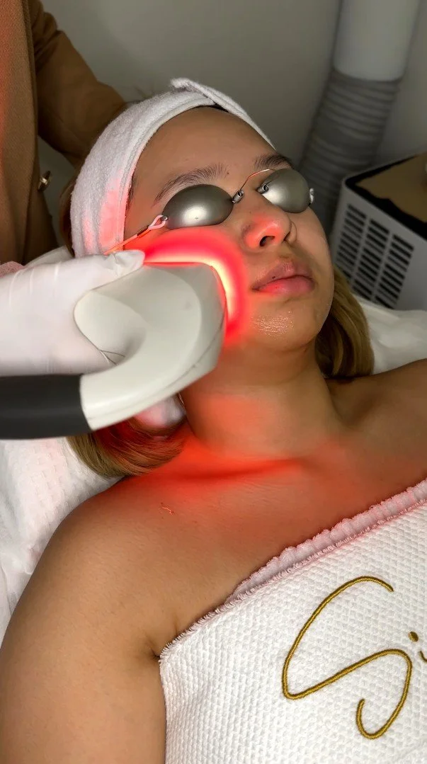A woman receiving a laser facial treatment while lying on a bed, wearing protective goggles, with a towel wrapped around her head.