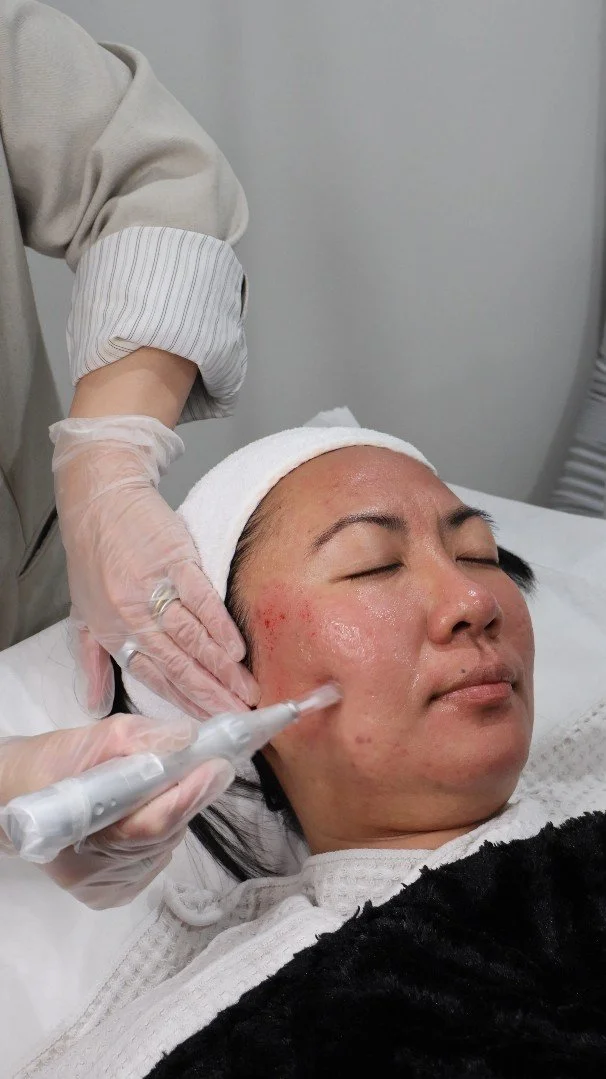 A woman receiving a facial treatment at a spa or clinic, with her eyes closed and a towel wrapped around her head, while a professional applies a skincare procedure using a handheld device.