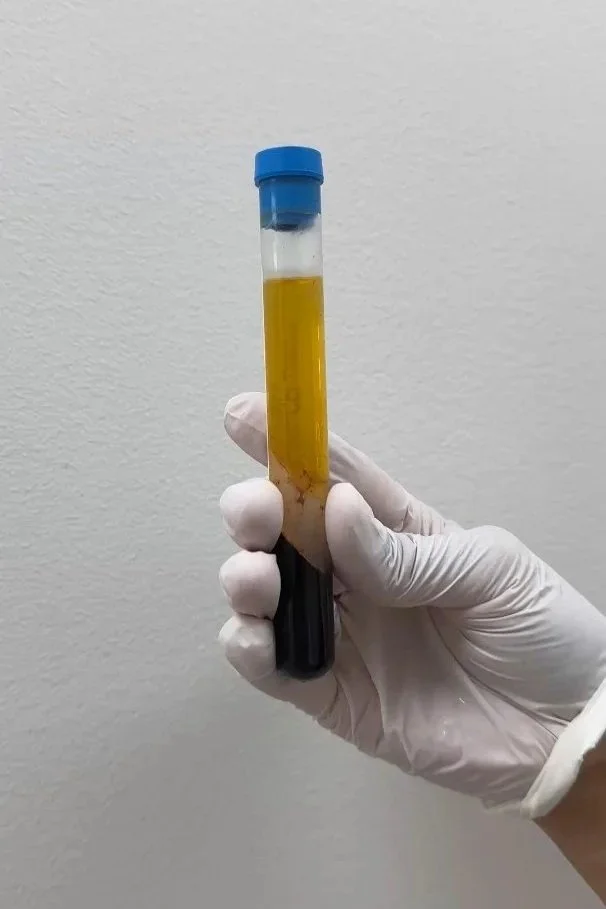 A gloved hand holding a test tube with yellow plasma and dark red blood at the bottom, sealed with a blue cap, against a plain wall background.