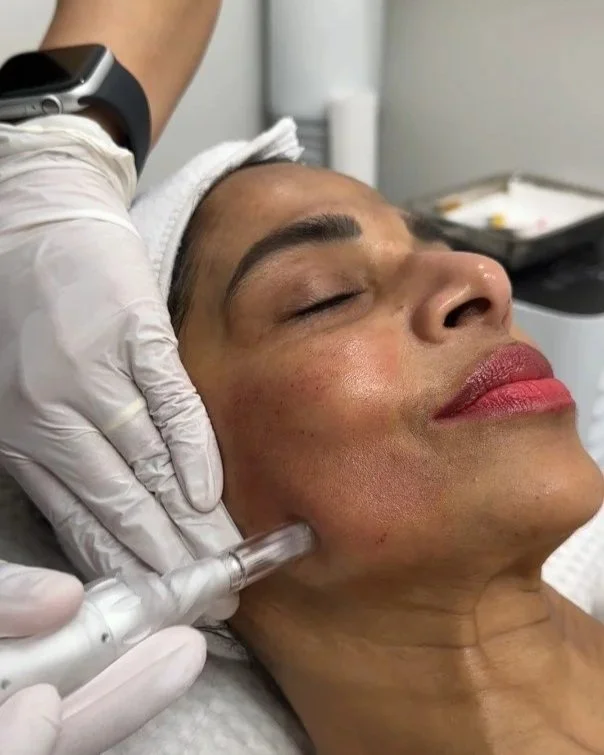 A woman receiving a cosmetic treatment on her jawline with a medical device, with a skincare professional wearing gloves performing the procedure in a clinical setting.