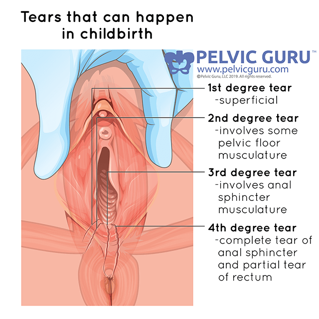 The pelvic floor · Pelvic Floor First