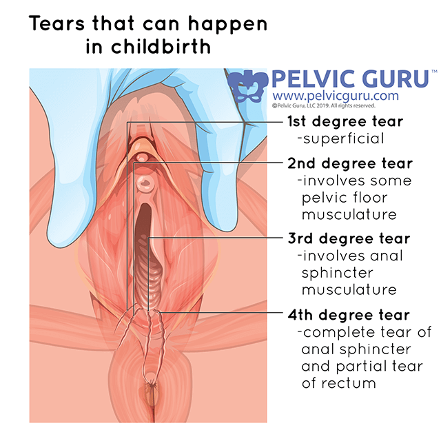 Delivery with an intact pelvic floor — New Journey Physical Therapy image