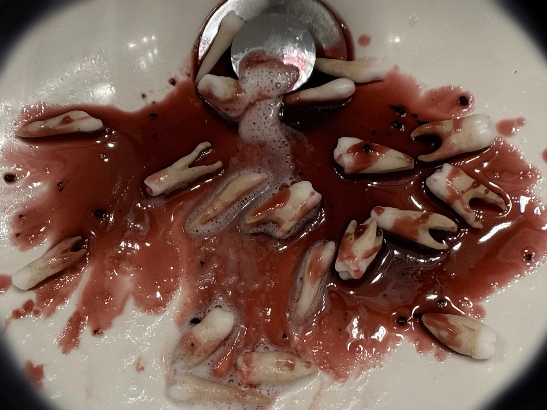 "Mom! ... I think my teeth fell out!"