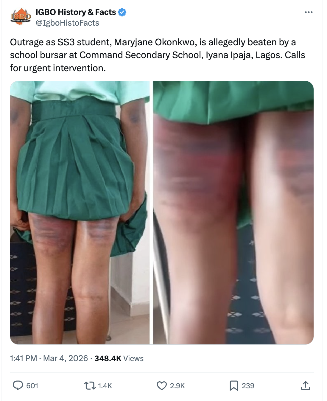 This is a screenshot of a post made on X by IGBO History & Facts handle; it shows two images of a black Nigerian girl's thighs with injuries from a beating she received from a school bursar; her skirt is dark green and her shirt is light green.