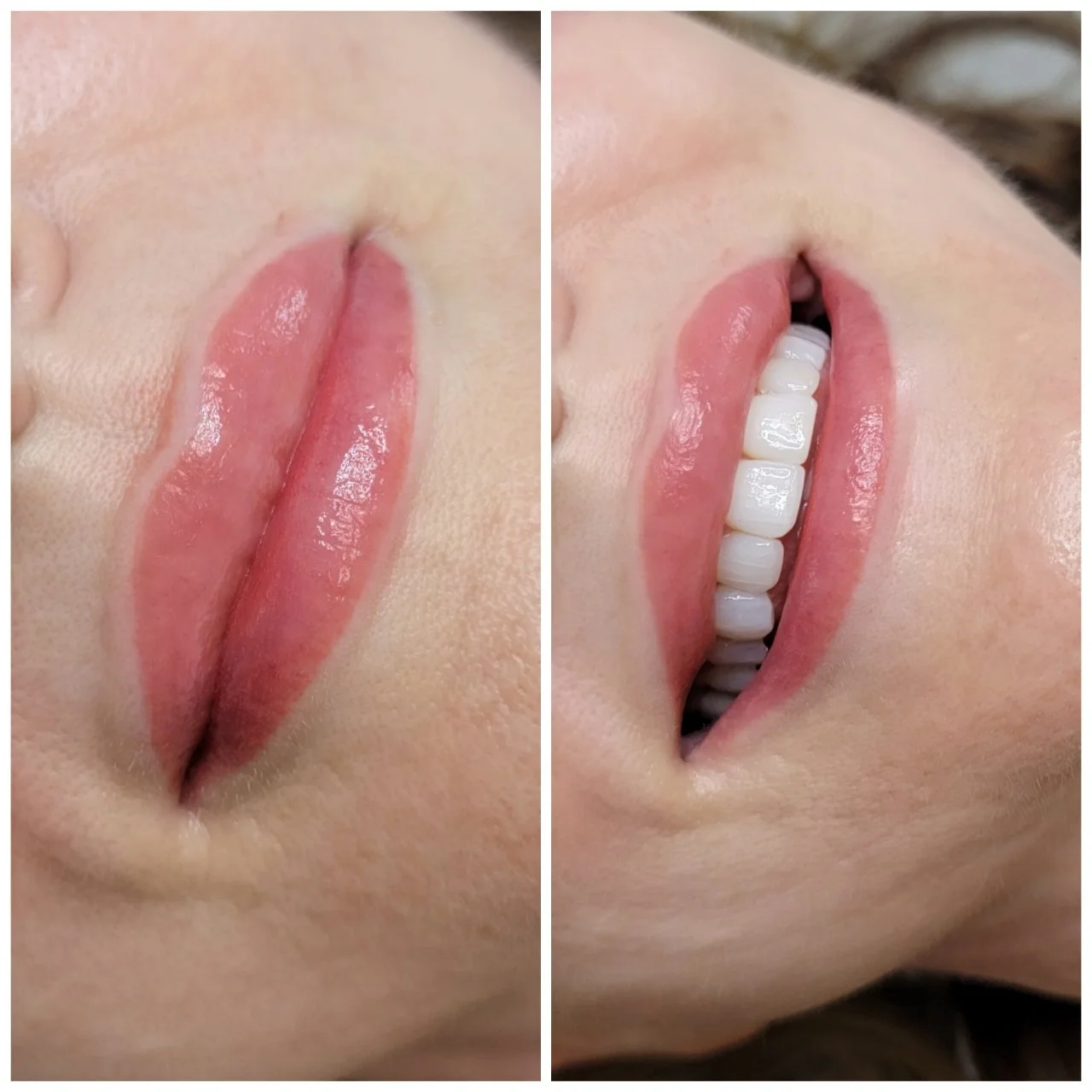 peach lip blushing before and after naples