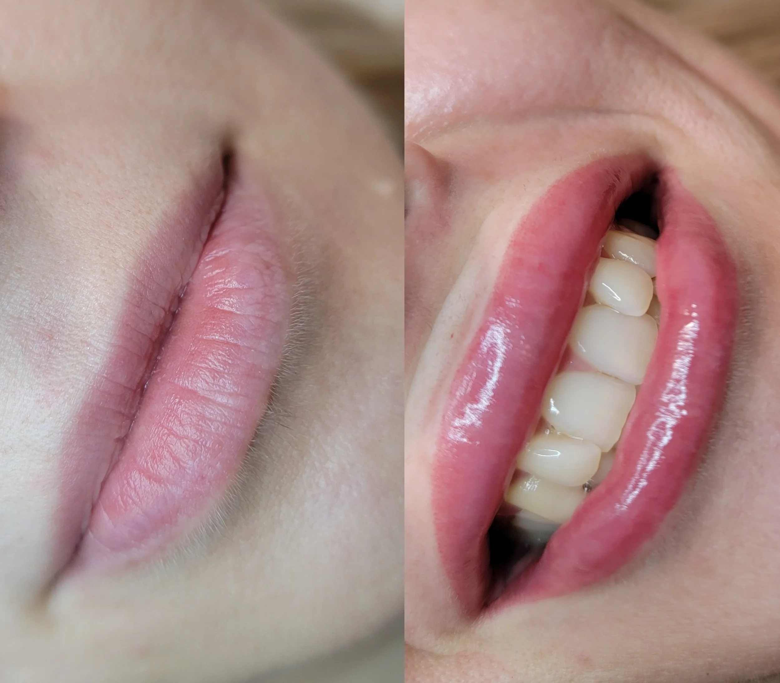 juicy lip blushing lips