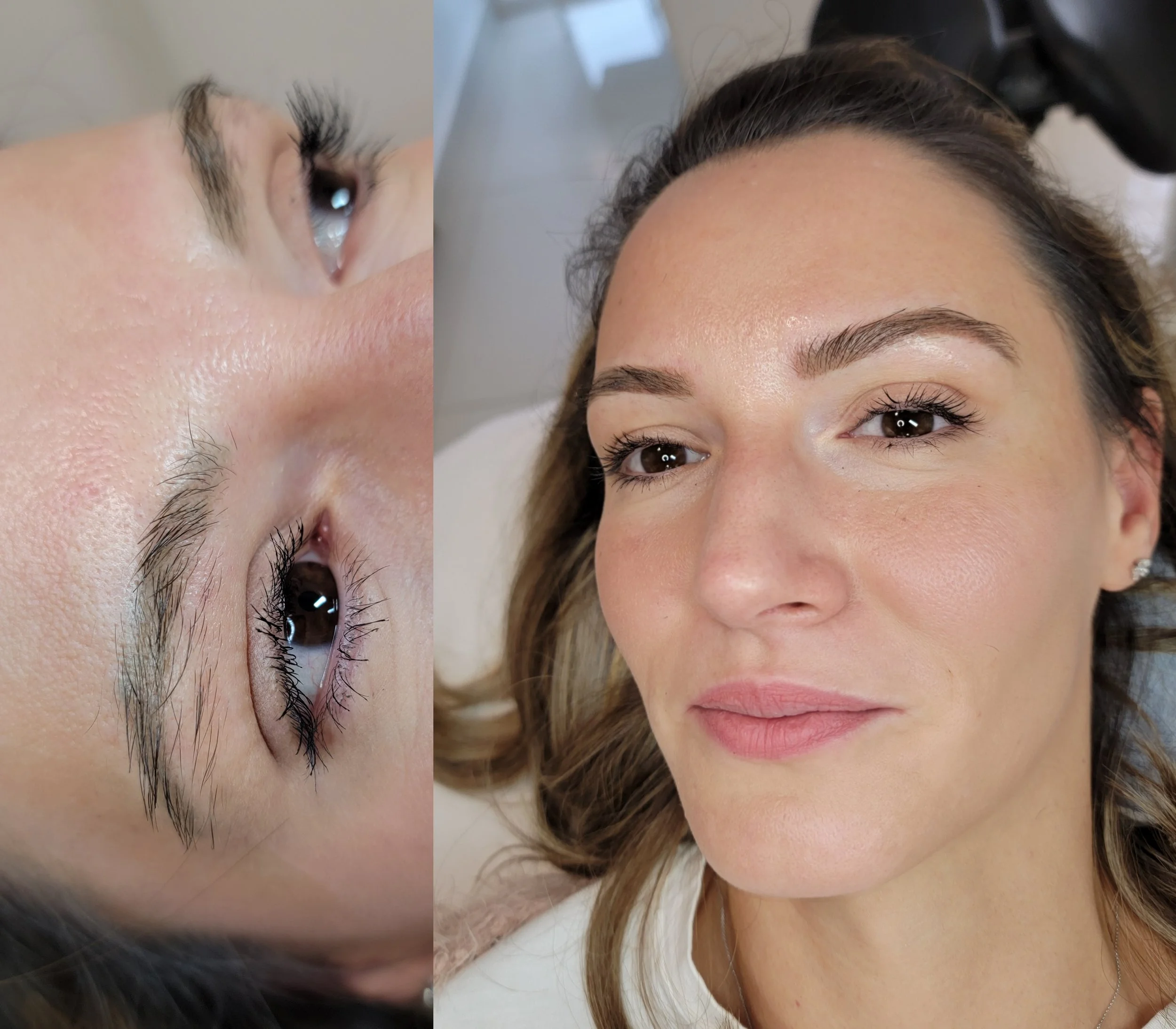 green brows tattoo laser removal