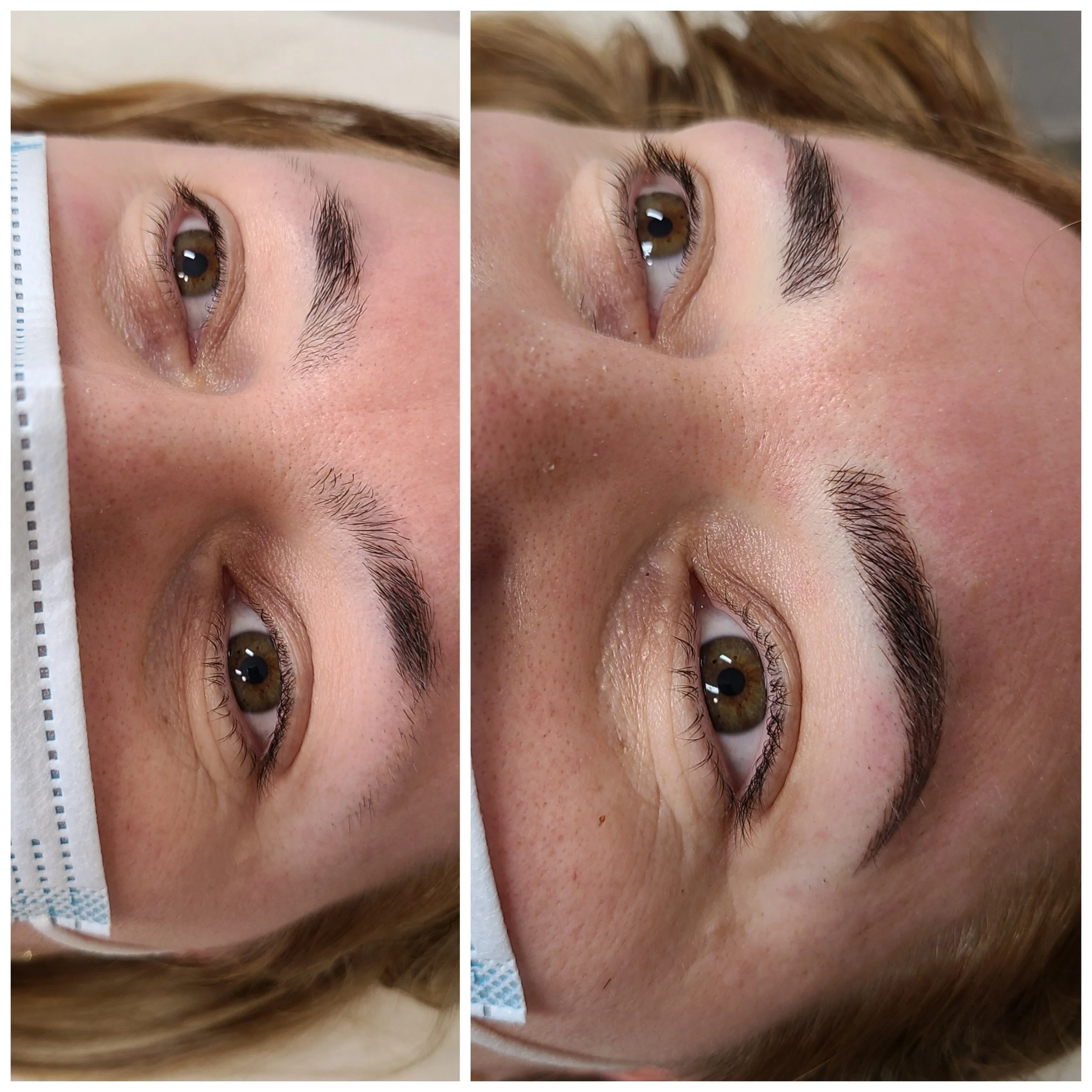 thricotillomania hair pulling microblading hairstrokes natural esthetic lines by alexandra
