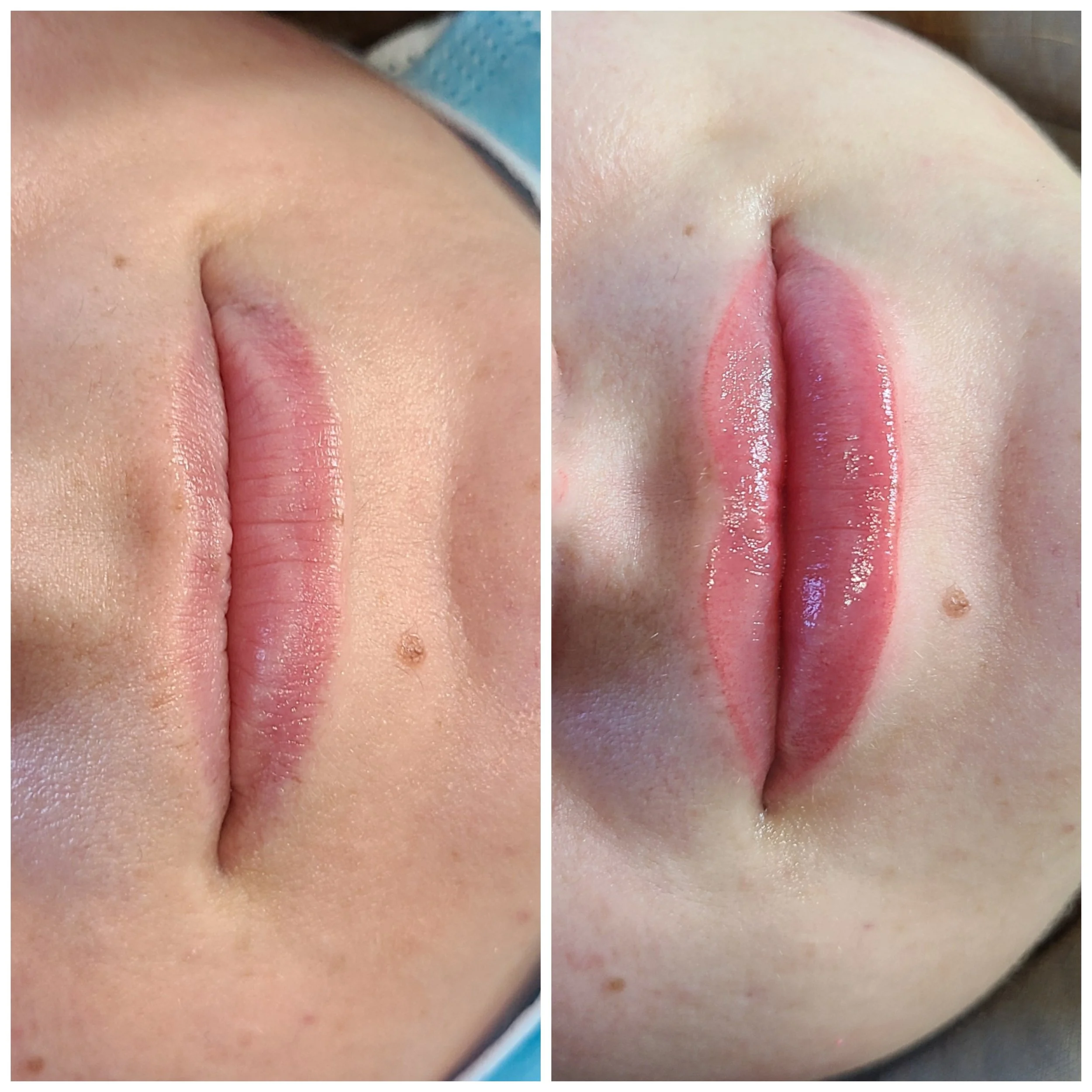 fresh lip blushing swelling before and after