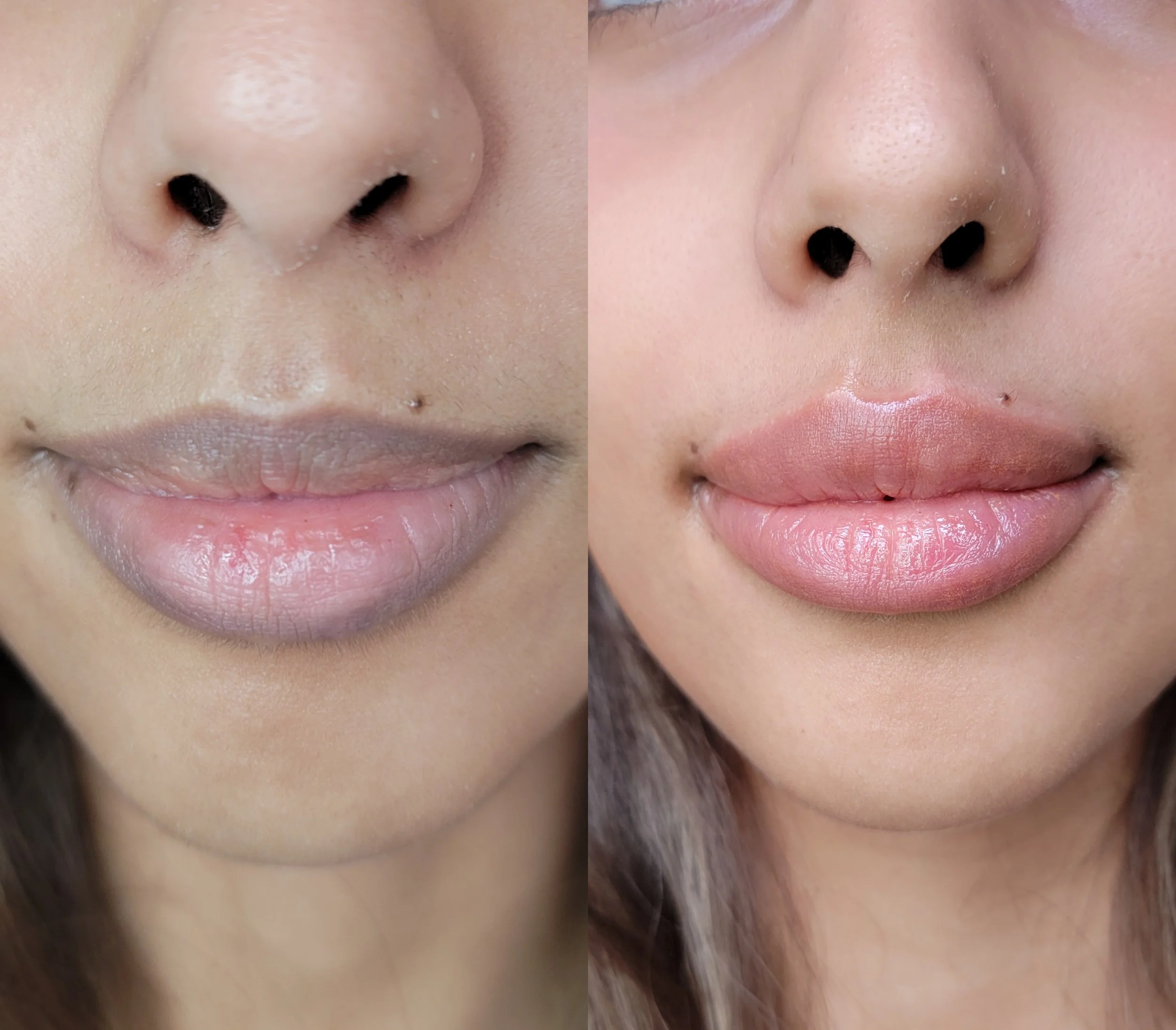 Color correction purple lips