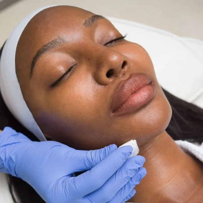 Even and Correct Peel Trio