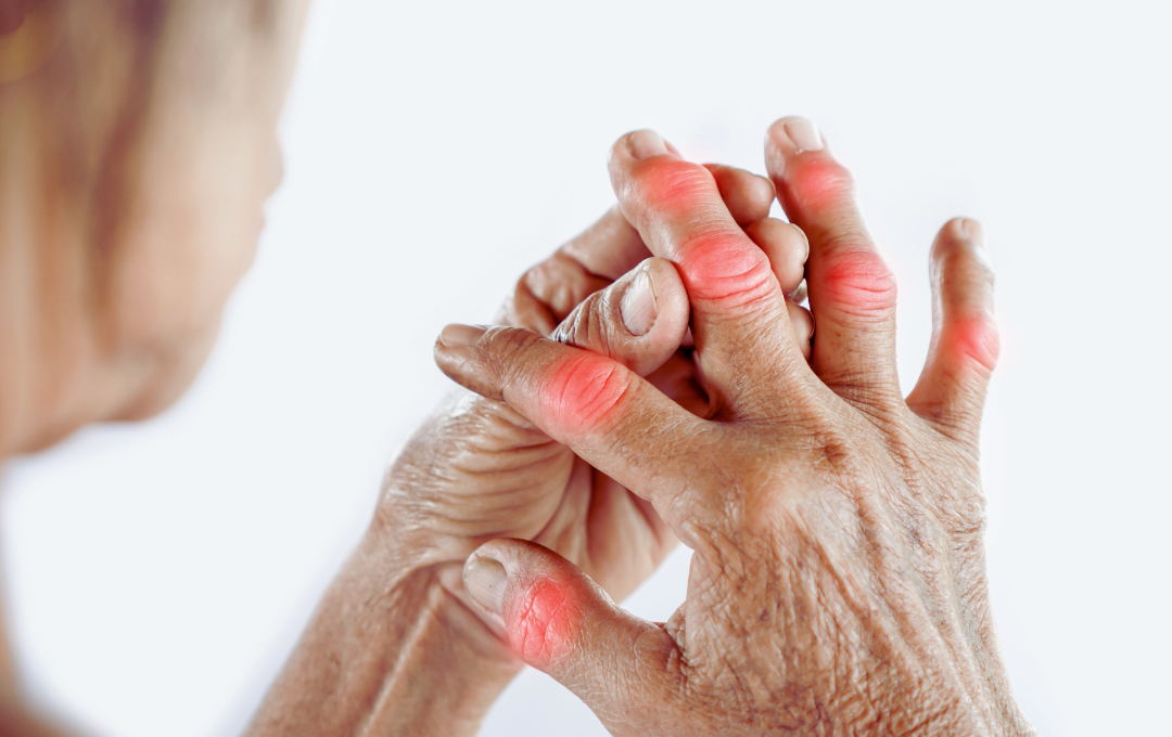 Chronic pain in hand-arthritis or aging